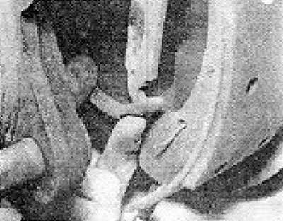 Photo 7.7. Disconnecting the handbrake cable from the brake shoe lever.
