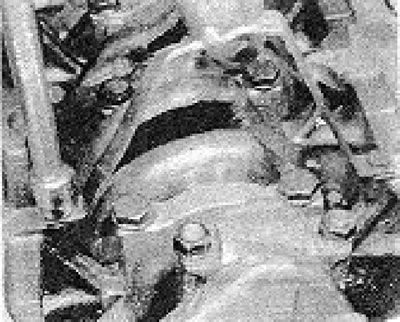 Снимка 46.184B. Опорна скоба на тръбата за засмукване на масло.