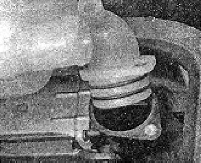 Photo 5.18. Removing the expansion tank from the radiator.